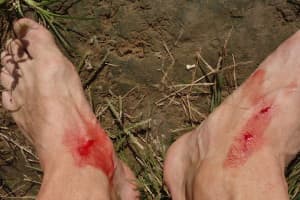 The 150 mile approach to the mountain involved numerous jungle hazards, including leeches (Mark Jenkins)