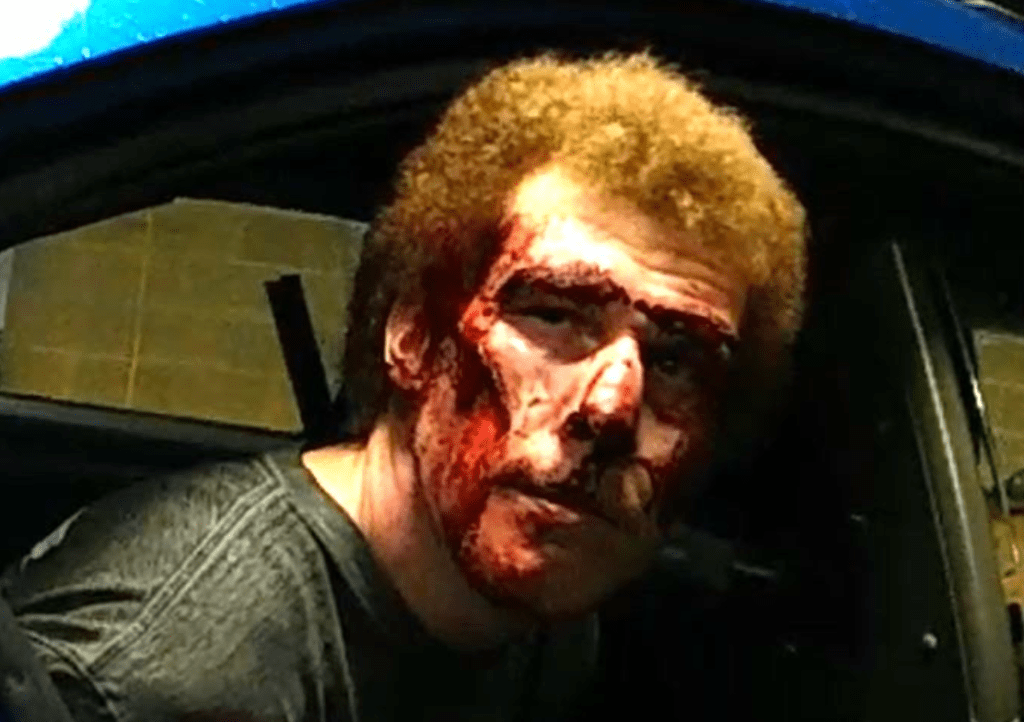 A man in the back of a police car with his face covered in blood